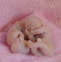 Fetal or Newborn Twins